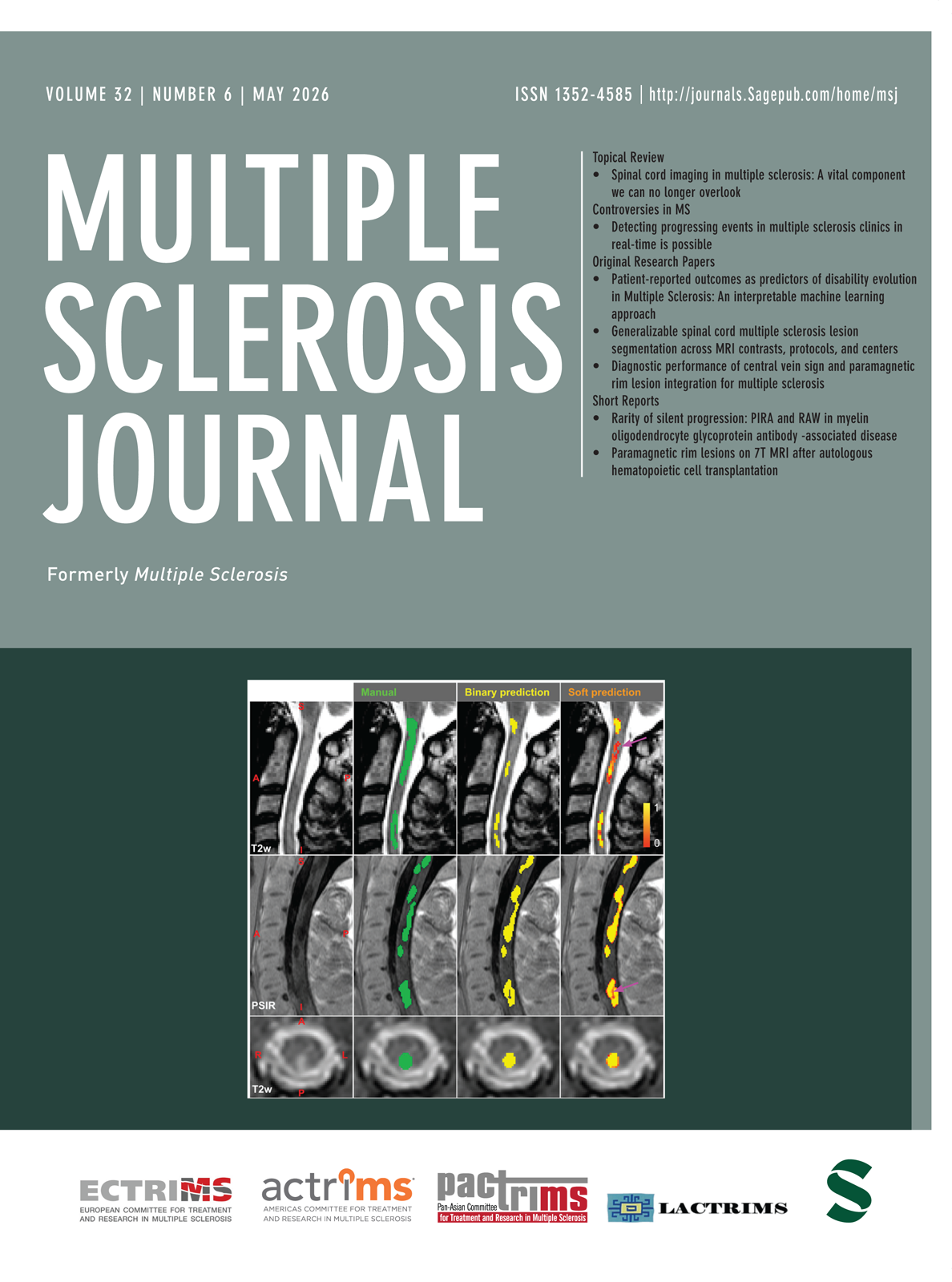Multiple Sclerosis Journal journal cover